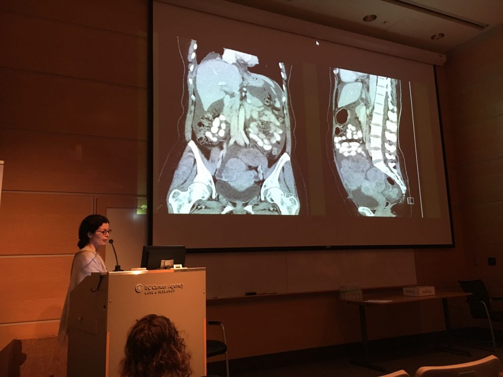 Gynecologic Cancer Education Forum Gynecologic Cancer Education Forum